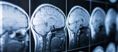 MVH Med Staff CME Library- Headache & Cardiovascular Disease 5/8/25 Banner